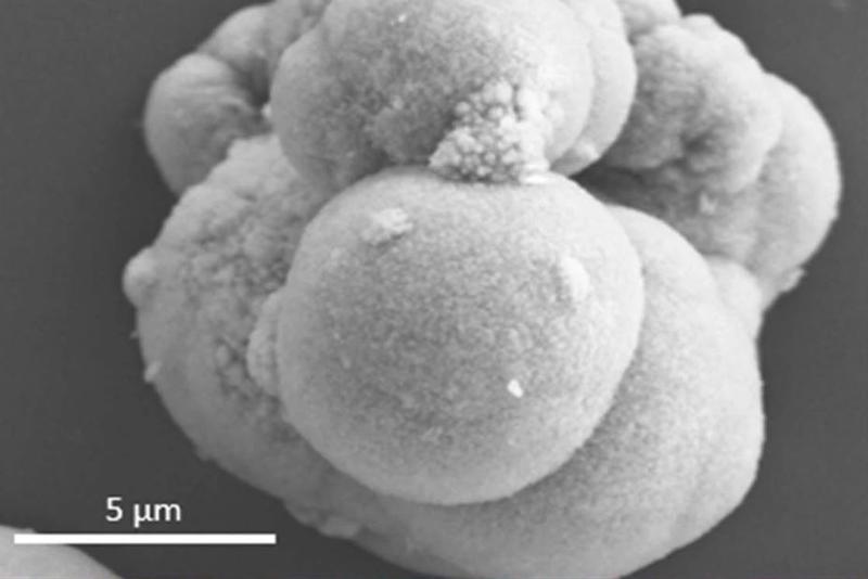 5um magnification of a detail of the sample