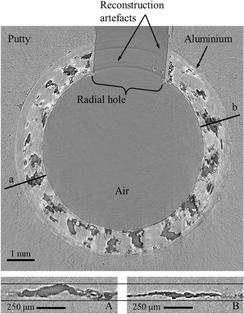 Axial tomography section with characteristic components