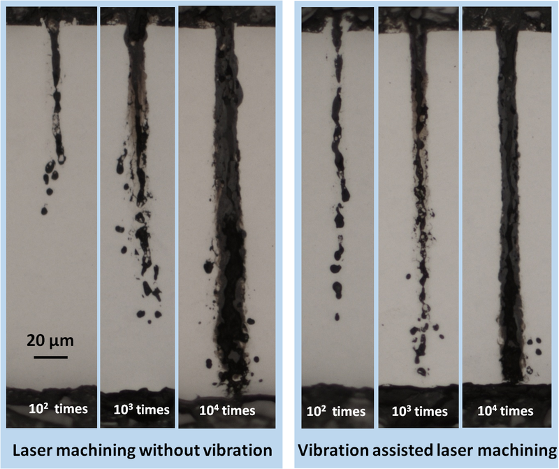 Vibration laser