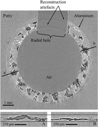 Axial tomography section with characteristic components